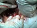 Ma. Lourdes Vaca MD Carlos Coronel MD Richard Chiriboga MD
