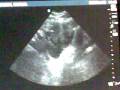 videos de -Nuestro bebe! NemoX-