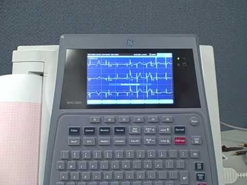 how to set up an ekg machine