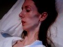 Anorexic woman