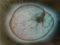 ONTOGENY
