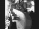 Razalas - Astigmatismo