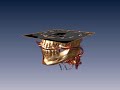 3D visualization of a head CT scan 3D visualization of a head CT scan