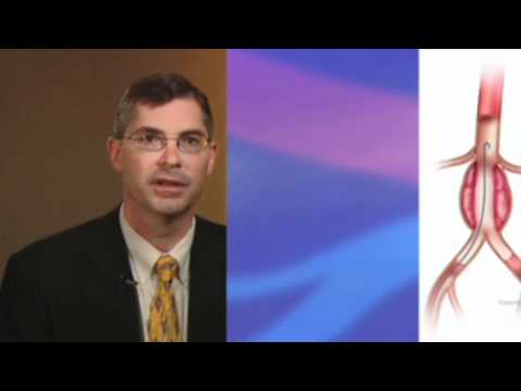 how to repair abdominal aortic aneurysm