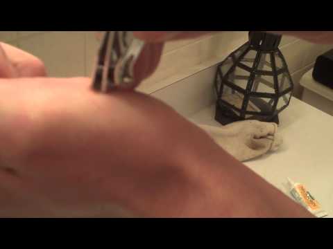 how to get rid of a wart