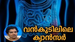 Dr Q : വന്‍കുടിലിലെ ക്യാന്‍സര്‍ | Colon Cancer | 12th March 2019