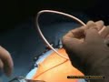Applicazione di un drenaggio toracico Applicazione di un drenaggio toracico