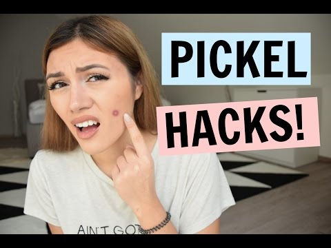 PICKEL HACKS! ▹ AnnaMaria ♡