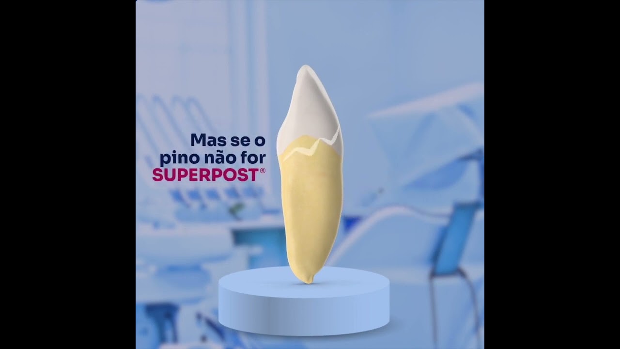 Pinos de metal X Fibra de Vidro.