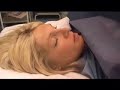 Birth by C Section