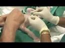 Birth by C Section