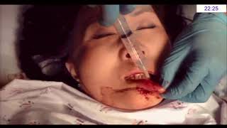 hospital basic - Basic ontrol of Wound - 충북의대 인용남 교수님