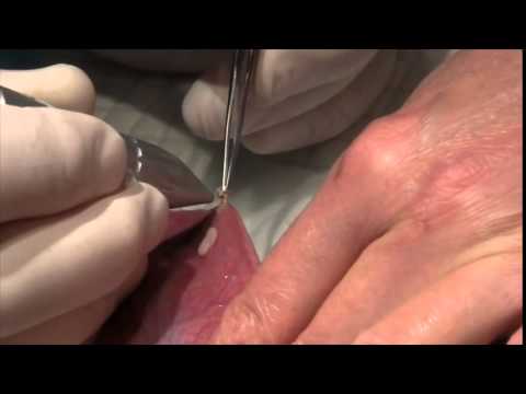how to remove skin from ox tongue