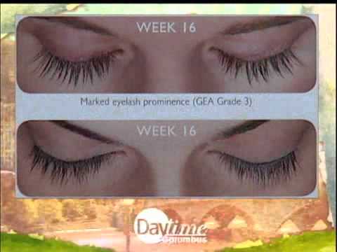 lastisse columbus - Dr. Kristen Kenney, M.D. appears on Daytime Columbus with Gail Hogan to discuss Latisse -- the first and only FDA-approved prescription treatment for inadequ...