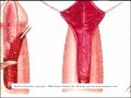 Breakthrough in Urinary Surgery Breakthrough in Urinary Surgery