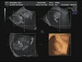 Baby Kennington (10 weeks 2 days) Baby Kennington (10 weeks 2 days)