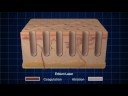 Cutera Pearl Fractional for Photodamage Reduction Treatment Cutera Pearl Fractional for Photodamage Reduction Treatment