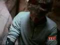 Aron Ralston describes the amputation