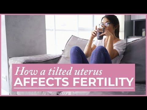 how to get pregnant with a tilted uterus