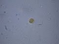 Dinoflagellate Swims the Salt Pond