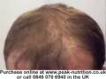 videos de Amazing Nanofibres to thicken thin hair and cover up thinning hair