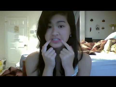 how to cure angular cheilitis