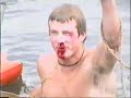 Bloody broken nose bike wreck
