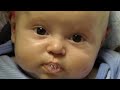 This is a video was made for Tripp. I wanted to spread his word and show everybody what he has been through from the day he was born. On May 14, 2009 was the day my life as well as my other family members life had changed for the better. I will never forget the first day me and Tripp met. He was so beautiful and yet he looked like a normal baby. Thanks to everyone who has gone out there way to do something for Tripp and his mom and thanks to everyone who has been praying for my little boy. He is truly a miracle and taught me a lot of things. I am so proud of his strength through this battle. I am also proud to be able to be his aunt. I LOVE YOU BIG BOY!