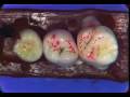 Dental Anatomy: Maxillary Molars Review