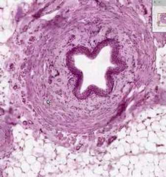 Shotgun Histology Ureter