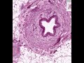 Shotgun Histology Ureter