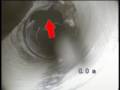 Video screenshot