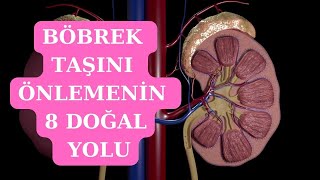 Böbrek taşını önlemenin 8 doğal yolu