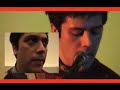 Gepe- La enfermedad de los ojos