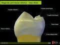 Atlas Dental 3D.AVI