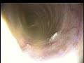 Sea Turtle Bronchoscopy I Sea Turtle Bronchoscopy I