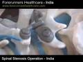 Cheap cost spinal stenosis treatment in India