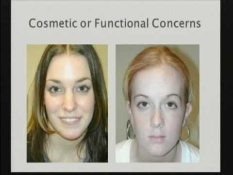 The Sentinel Node – A Potential Key to New Therapies, 2010
