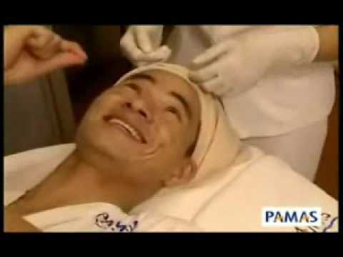 Xuân Bắc đi trị mụn0 