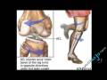 joint pain