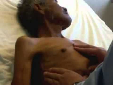 how to assess hepatojugular reflux