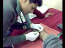 Karan Getting Stiches after an accident