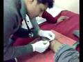 Karan Getting Stiches after an accident