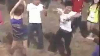ตัวอย่างคนที่ไม่เป็นโรคกระดูก