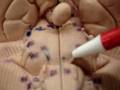 Cranial Nerves