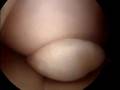 Knee Injury, The Locking Knee