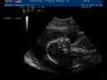 videos de BREZNAU STEPHANIE 20081120172339 1732080