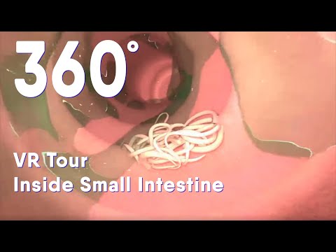 Small intestine with intestinal worms 360 VR |Intestinal Parasites |medical animation #intestin #360 - YouTube