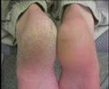 Foot Problems can kill Foot Problems can kill