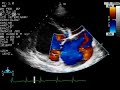 Mitral Regurgitation - Color Doppler Echocardiogram - Dog